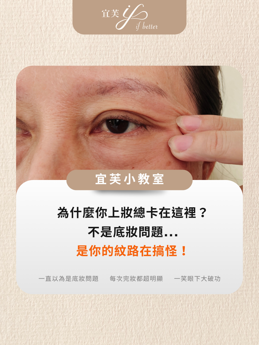 眼下細紋1