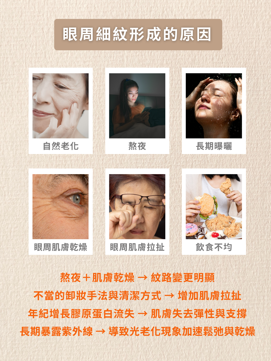眼下細紋2