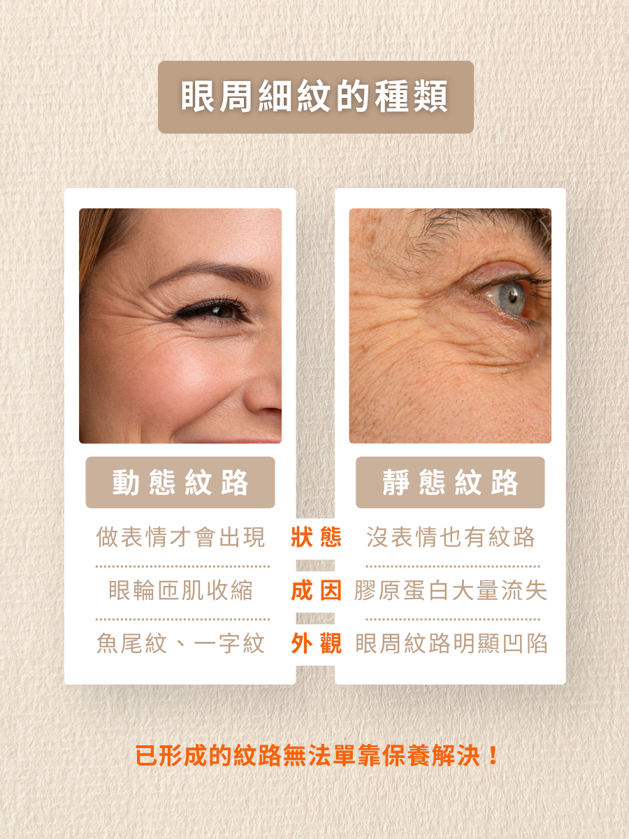 眼下細紋3