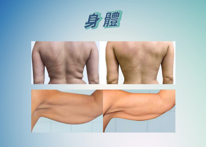 雙療程9