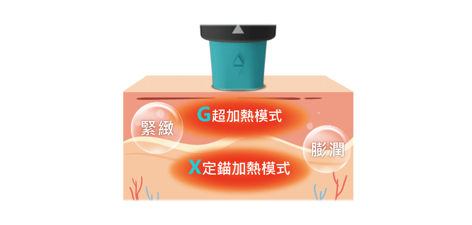 超玩美電波ＧＸＧ定錨