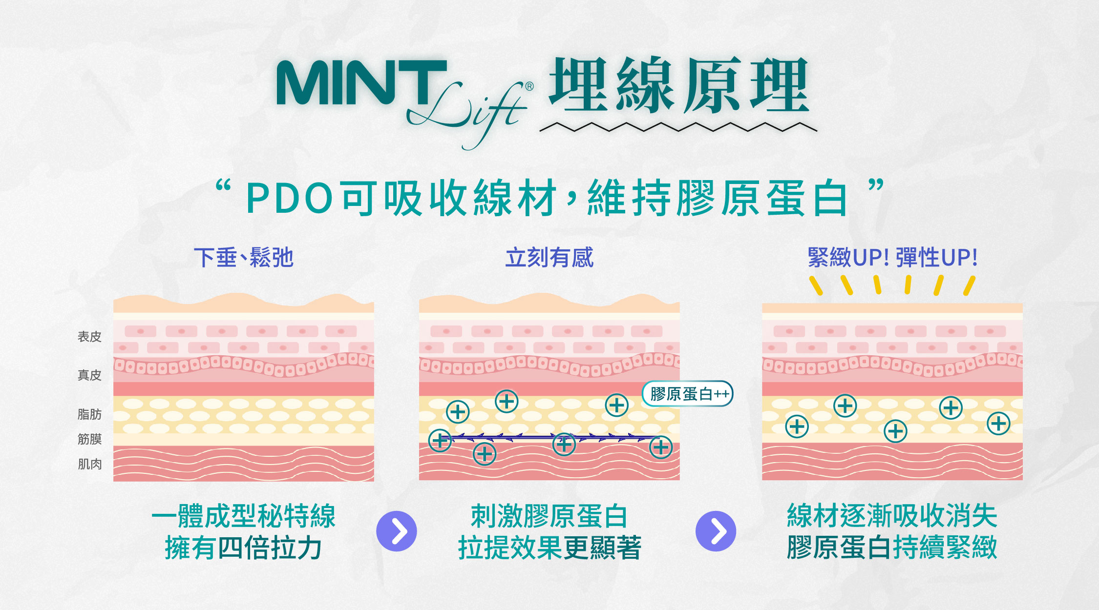 神力拉提治療原理圖