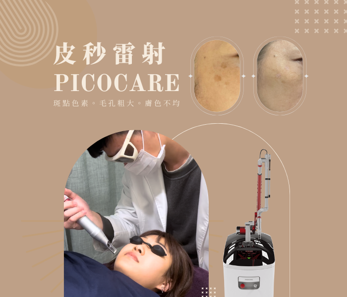 皮秒雷射,宜芙醫美診所,桃園皮秒,中壢皮秒,除斑,皮秒蜂巢,picocare