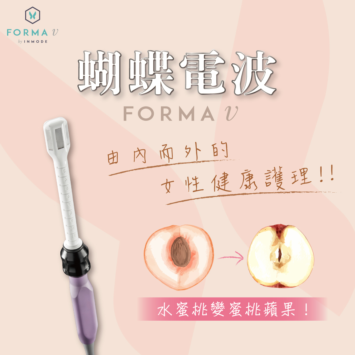 蝴蝶電波,女性私密保養,陰道緊實,產後漏尿